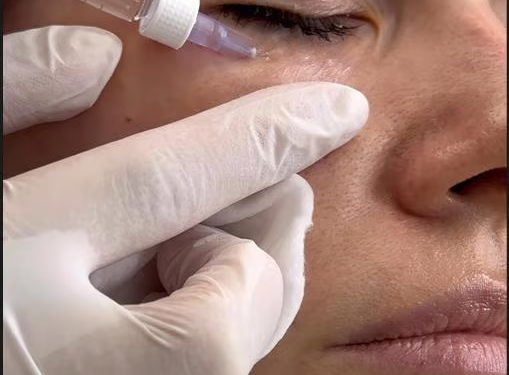MamaRika pokazała, jak robi zastrzyki kosmetyczne