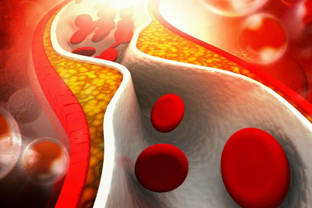 Odkryto Najprostszy Sposób Na Obniżenie Poziomu Cholesterolu Badania Naukowców 0187