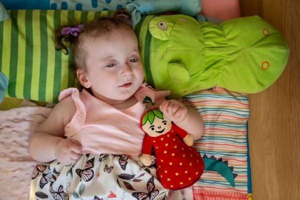  Единственная в мире: девочка родилась с ультрауникальным состоянием (фото) 