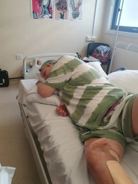 
Женщина поцарапала ногу на рыбалке и перенесла 55 операций: теперь она просит ампутацию (фото)
