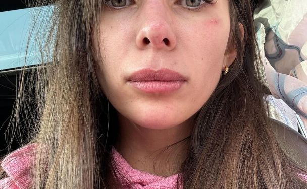 Anna Neplyakh miała straszny wypadek: samochód został zniszczony