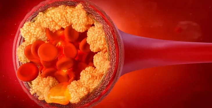 Jak obniżyć cholesterol: lekarze mówili, co włączyć do swojej diety