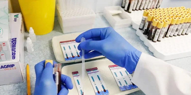 W obwodzie lwowskim gwałtownie wzrosła liczba pacjentów zakażonych wirusem HIV: podano przyczynę