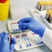 W obwodzie lwowskim gwałtownie wzrosła liczba pacjentów zakażonych wirusem HIV: podano przyczynę