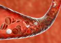 Produkt cholesterolowy: lekarze mówili, co dodać do swojej diety