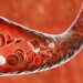 Produkt cholesterolowy: lekarze mówili, co dodać do swojej diety