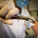 Jednemu mężczyźnie w ciągu jednego dnia usunięto 23 zęby i wszczepiono 12 implantów – zmarł