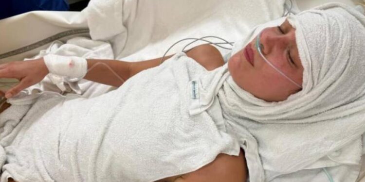 Bella Hadid została hospitalizowana z powodu zaostrzenia choroby z Lyme. Matka modelki, Yolanda, podzieliła się zdjęciami i zwróciła się do córki słowami wsparcia.